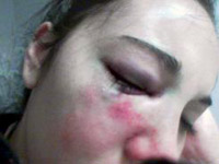 ����F�A���T����